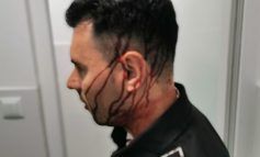 Incident grav la Galați. Polițiștii locali au fost atacați cu obiecte aruncate de la înălțime, un agent a ajuns la spital